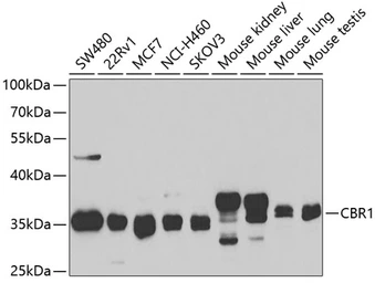 Anti-CBR1 antibody used in Western Blot (WB). GTX53925