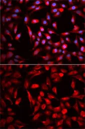Anti-CBR1 antibody used in Immunocytochemistry/ Immunofluorescence (ICC/IF). GTX53925