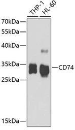 Anti-CD74 antibody used in Western Blot (WB). GTX53927
