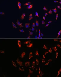 Anti-CD74 antibody used in Immunocytochemistry/ Immunofluorescence (ICC/IF). GTX53927