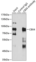 Anti-CBX4 antibody used in Immunoprecipitation (IP). GTX53928
