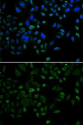 Anti-CBX8 antibody used in Immunocytochemistry/ Immunofluorescence (ICC/IF). GTX53929