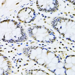Anti-CBX8 antibody used in IHC (Paraffin sections) (IHC-P). GTX53929