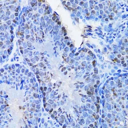 Anti-CBX8 antibody used in IHC (Paraffin sections) (IHC-P). GTX53929