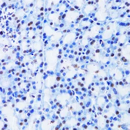 Anti-CBX8 antibody used in IHC (Paraffin sections) (IHC-P). GTX53929