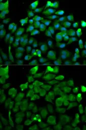Anti-Cullin 3 antibody used in Immunocytochemistry/ Immunofluorescence (ICC/IF). GTX53933