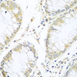 Anti-Cullin 3 antibody used in IHC (Paraffin sections) (IHC-P). GTX53933
