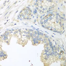 Anti-Cullin 3 antibody used in IHC (Paraffin sections) (IHC-P). GTX53933