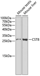 Anti-Cystatin 8 antibody used in Western Blot (WB). GTX53934