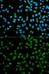 Anti-Cystatin 8 antibody used in Immunocytochemistry/ Immunofluorescence (ICC/IF). GTX53934