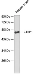 Anti-CtBP1 antibody used in Western Blot (WB). GTX53940