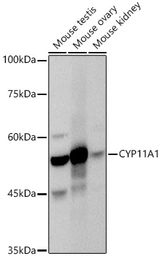 Anti-CYP11A1 antibody used in Western Blot (WB). GTX53941