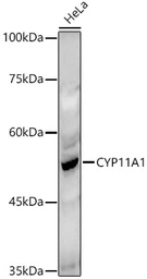 Anti-CYP11A1 antibody used in Western Blot (WB). GTX53941
