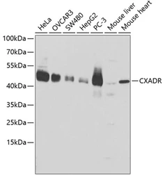Anti-Coxsackie Adenovirus Receptor antibody used in Western Blot (WB). GTX53942