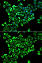 Anti-CDA antibody used in Immunocytochemistry/ Immunofluorescence (ICC/IF). GTX53944