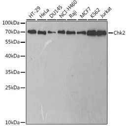 Anti-Chk2 antibody used in Western Blot (WB). GTX53946