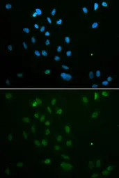 Anti-Chk2 antibody used in Immunocytochemistry/ Immunofluorescence (ICC/IF). GTX53946