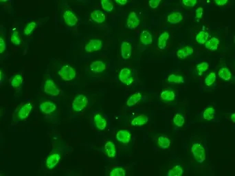 Anti-Chk2 antibody used in Immunocytochemistry/ Immunofluorescence (ICC/IF). GTX53946