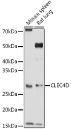 Anti-CLEC4D antibody used in Western Blot (WB). GTX53950
