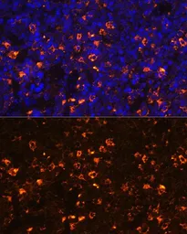 Anti-CLEC4D antibody used in IHC (Paraffin sections) (IHC-P). GTX53950
