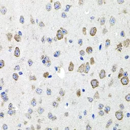 Anti-CDH23 antibody used in IHC (Paraffin sections) (IHC-P). GTX53952