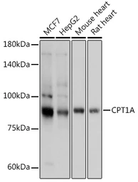 Anti-CPT1A antibody used in Western Blot (WB). GTX53954