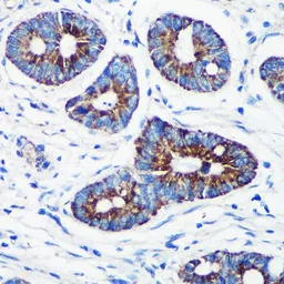 Anti-CPT1A antibody used in IHC (Paraffin sections) (IHC-P). GTX53954