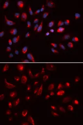 Anti-mAChR M5 antibody used in Immunocytochemistry/ Immunofluorescence (ICC/IF). GTX53955