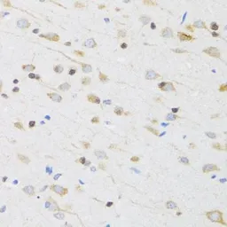 Anti-mAChR M5 antibody used in IHC (Paraffin sections) (IHC-P). GTX53955