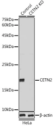 Anti-Centrin 2 antibody used in Western Blot (WB). GTX53956