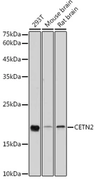 Anti-Centrin 2 antibody used in Western Blot (WB). GTX53956