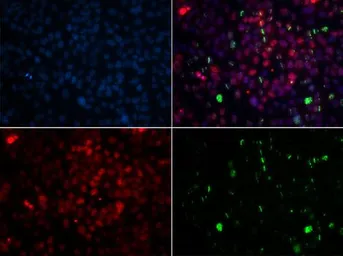 Anti-Centrin 2 antibody used in Immunocytochemistry/ Immunofluorescence (ICC/IF). GTX53956