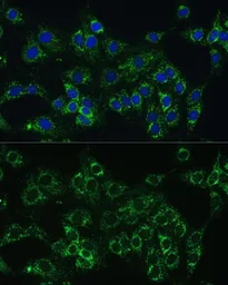 Anti-Cytochrome b5 antibody used in Immunocytochemistry/ Immunofluorescence (ICC/IF). GTX53959