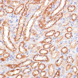 Anti-Cytochrome b5 antibody used in IHC (Paraffin sections) (IHC-P). GTX53959