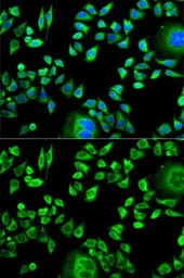 Anti-Cystatin A antibody used in Immunocytochemistry/ Immunofluorescence (ICC/IF). GTX53962