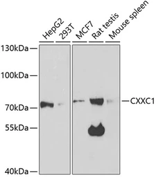 Anti-CGBP antibody used in Western Blot (WB). GTX53967