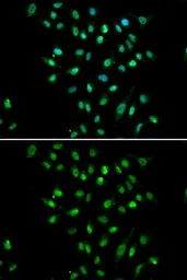 Anti-CGBP antibody used in Immunocytochemistry/ Immunofluorescence (ICC/IF). GTX53967