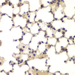 Anti-CGBP antibody used in IHC (Paraffin sections) (IHC-P). GTX53967