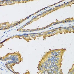 Anti-CXCL11 antibody used in IHC (Paraffin sections) (IHC-P). GTX53969