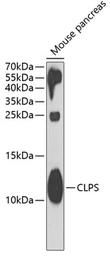 Anti-CLPS antibody used in Western Blot (WB). GTX53973