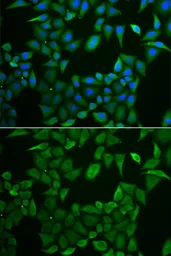 Anti-CLPS antibody used in Immunocytochemistry/ Immunofluorescence (ICC/IF). GTX53973
