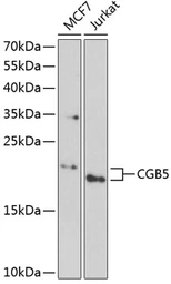 Anti-hCG beta 5 antibody used in Western Blot (WB). GTX53974