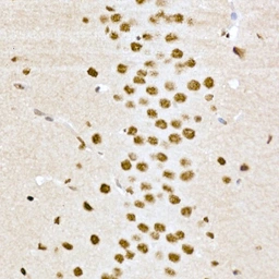 Anti-CREB (phospho Ser133) antibody used in IHC (Paraffin sections) (IHC-P). GTX53975