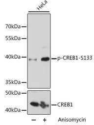 Anti-CREB (phospho Ser133) antibody used in Western Blot (WB). GTX53975