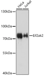 Anti-PKR antibody used in Western Blot (WB). GTX53983