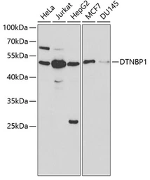 Anti-Dysbindin antibody used in Western Blot (WB). GTX53985
