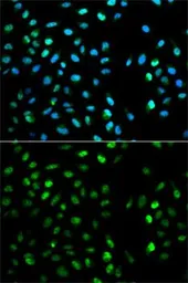 Anti-Dysbindin antibody used in Immunocytochemistry/ Immunofluorescence (ICC/IF). GTX53985