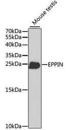 Anti-SPINLW1 antibody used in Western Blot (WB). GTX53988