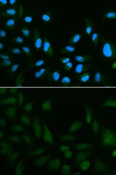 Anti-SPINLW1 antibody used in Immunocytochemistry/ Immunofluorescence (ICC/IF). GTX53988