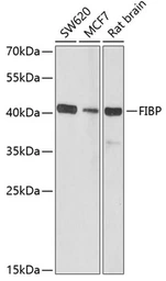 Anti-FIBP antibody used in Western Blot (WB). GTX53989
